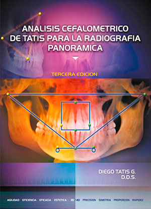 Análisis Cefalométrico de Tatis Para la Radiografía Panorámica